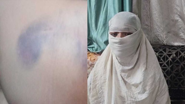 युवती का आरोप की उसे गौ-मांस खिलाकर धर्म परिवर्तन के लिए मजबूर किया गया