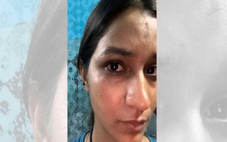 CG फिल्म अभिनेत्री से ट्रेन में लूट की कोशिश, चेहरे पर हमला कर नकाबपोश हुआ फरार