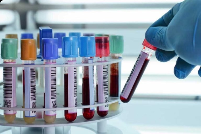 ग्वालियर के जिला अस्पताल में सर्वसुविधा युक्त IPHL की सुविधा इस महीने से मिलने लगेगी