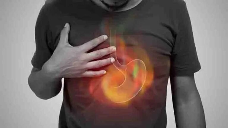 कहीं आपको हाइपर एसिडिटी तो नहीं!