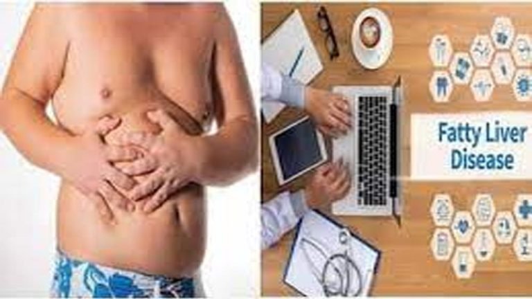 लंबे समय तक बैठकर काम करने वालों को खतरा, IT सेक्टर में फैटी लिवर के मामले 84% तक पहुंचे