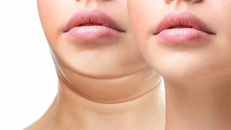 चेहरे की खूबसूरती बढ़ाएँ: ब्लड सर्कुलेशन सुधारने और डबल चिन हटाने वाले योगासन