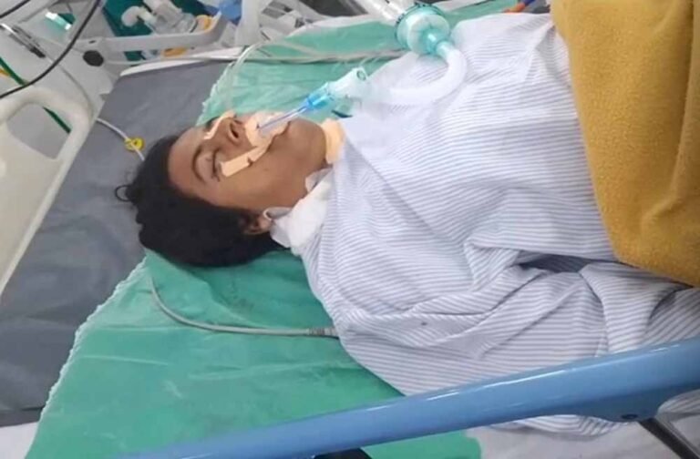 प्यार में पड़ा धोखा! जेल काटने के बाद प्रेमिका पर कैंची से जानलेवा वार