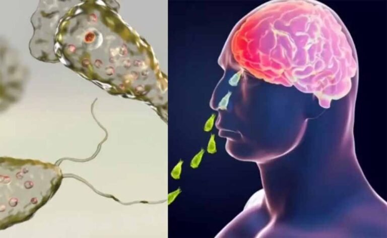 जानलेवा अमीबा ने केरल में ली 19 जानें, ऐसे करें अपनी सुरक्षा