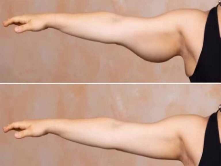 बाजू की ढीली मांसपेशियों को टोन्ड बनाने के लिए रोज करें ये 5 एक्सरसाइज, बढ़ जाएगी हाथों की ताकत