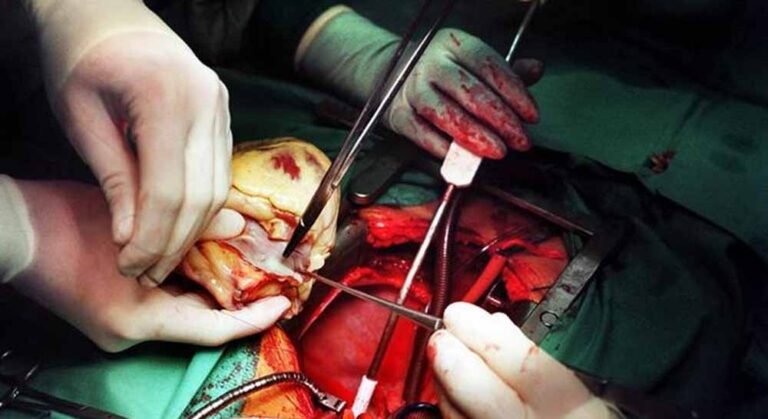 एक की मौत, दूसरे की नई सांस — इतिहास का सबसे विवादित दिल प्रत्यारोपण!