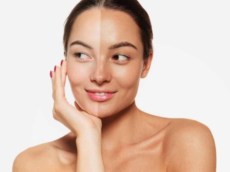 झुलसी त्वचा से छुटकारा: घर बैठे अपनाएँ ये 5 असरदार उपाय