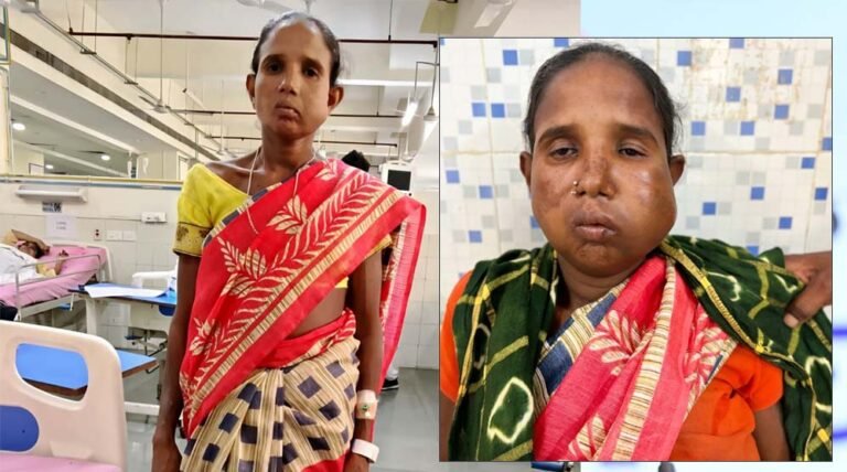 रायपुर में संजीवनी हेल्थ कैंप, प्रशासन की तत्परता से बुधरी मड़कम को एम्स रायपुर में मिला निःशुल्क इलाज