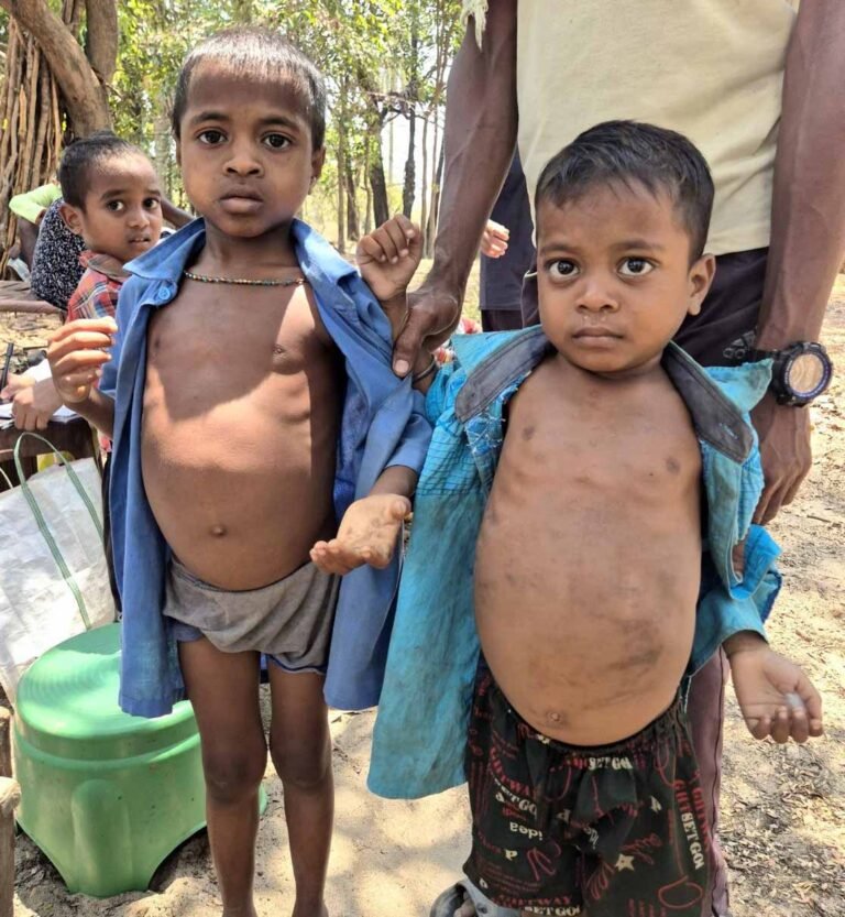 मुख्यमंत्री स्वस्थ बस्तर अभियान बना जीवन रक्षक, माड़वी नन्दे और सुमड़ी को मिली नई जिंदगी