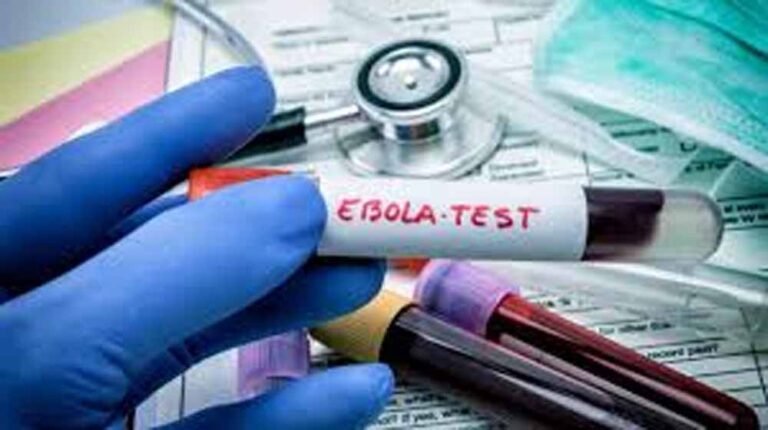 जयपुर एयरपोर्ट पर हड़कंप: 19 वर्षीय युवती में इबोला जैसे लक्षण, सैंपल पुणे भेजा गया