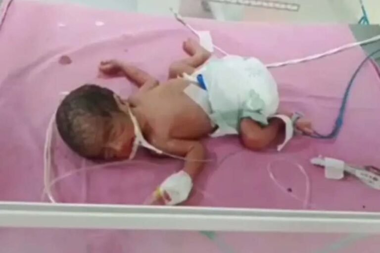 राजस्थान में दुर्लभ मामला, सिजेरियन से जन्मे तीन बेटियां और एक बेटा साथ