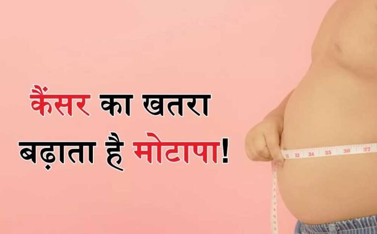 Cancer Alert: मोटापा और तनाव बना रहे बीमारी की वजह, पुरुषों में ओरल- महिलाओं में ब्रेस्ट कैंसर बढ़ा
